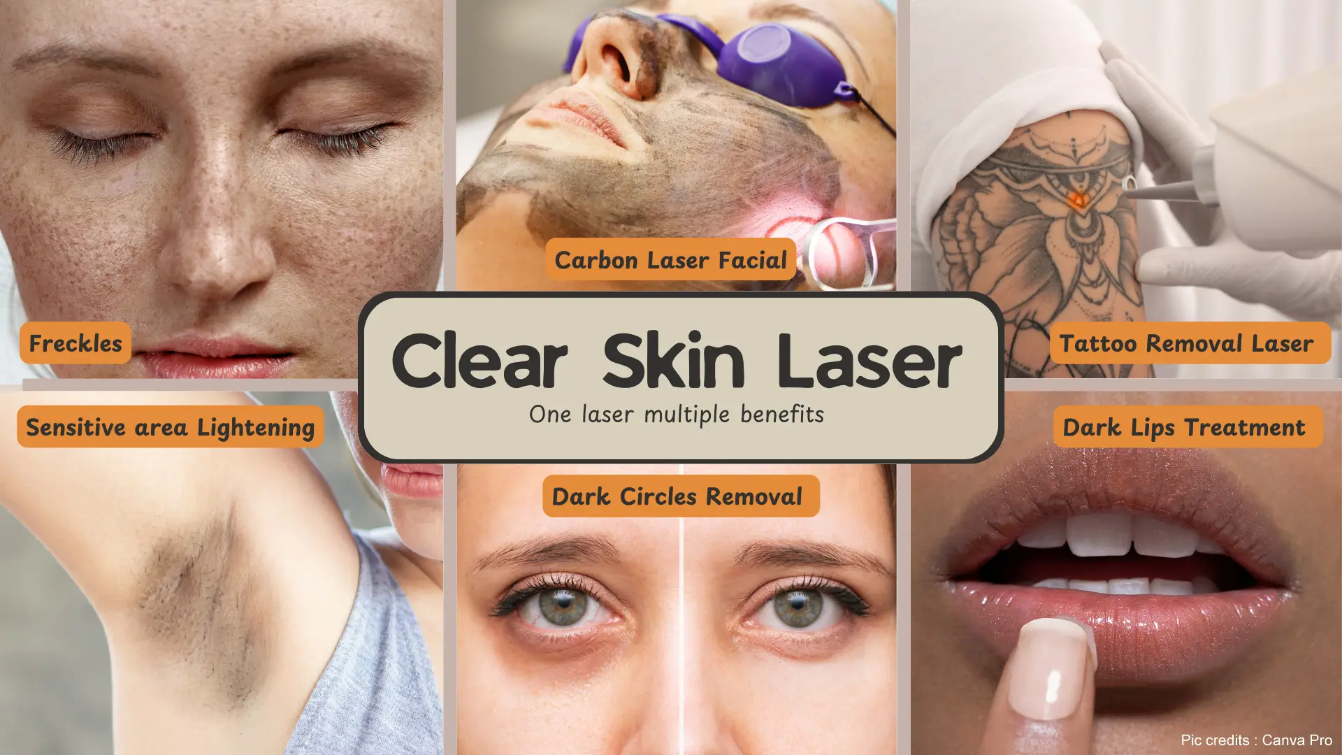 Clear Skin Laser