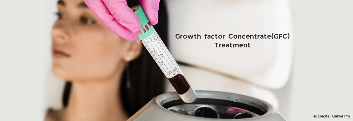 Growth Factor Concentrate (GFC) for Melasma Treatment