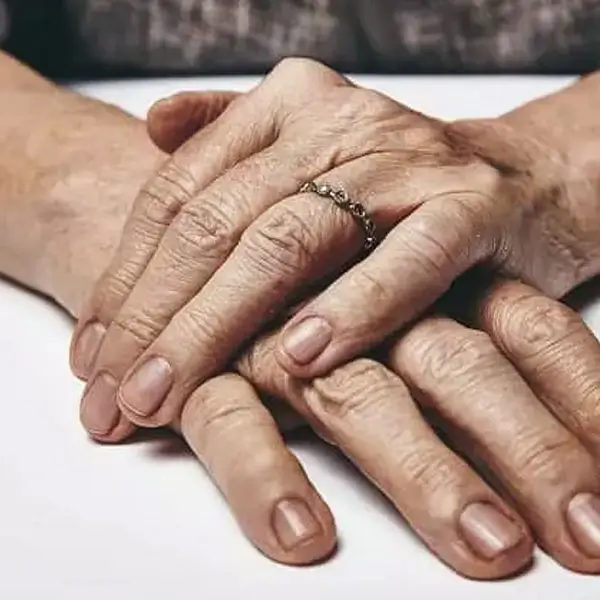 Hand aging treatments